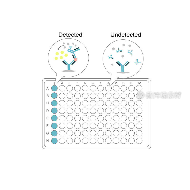 夹心酶联免疫吸附法检测蛋白的结果解释:已检测或未检测