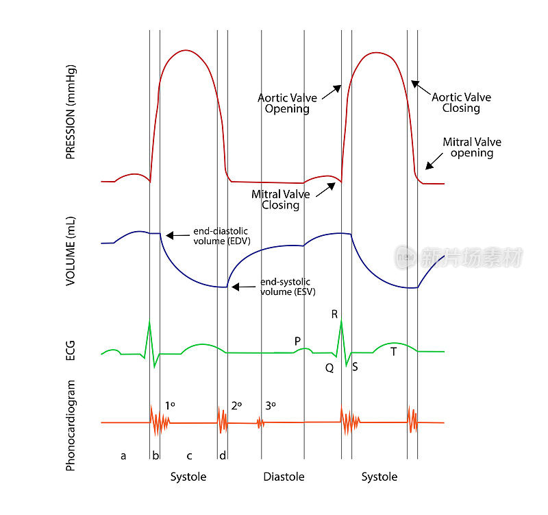 左室压力-容积环路、心电图和心音曲线