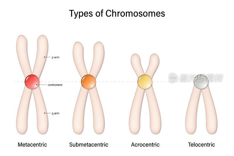 类型的染色体。稳心的，亚稳心的，远心的，远心的。染色体到着丝粒位置的分类。