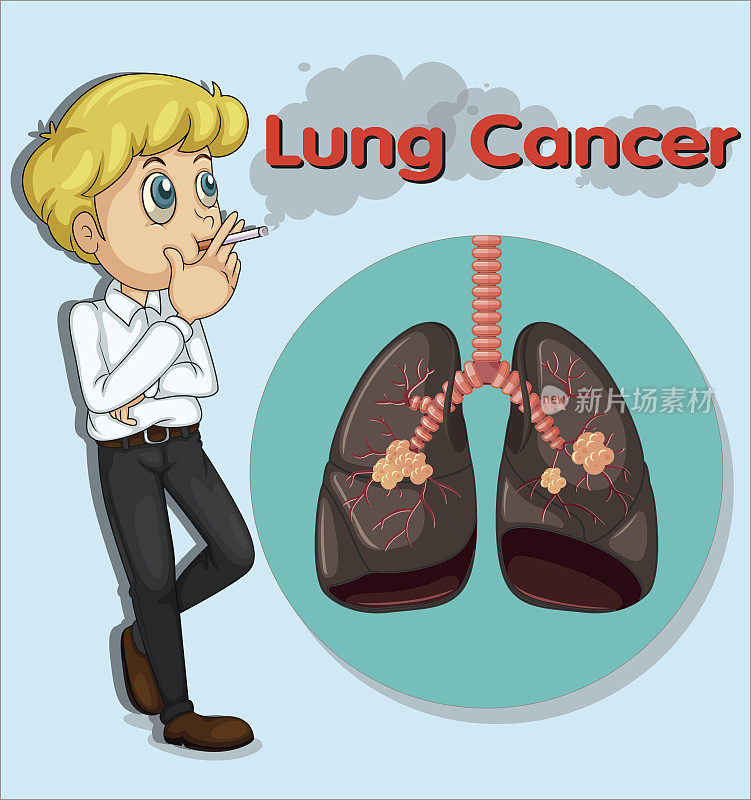 男人吸烟和肺癌