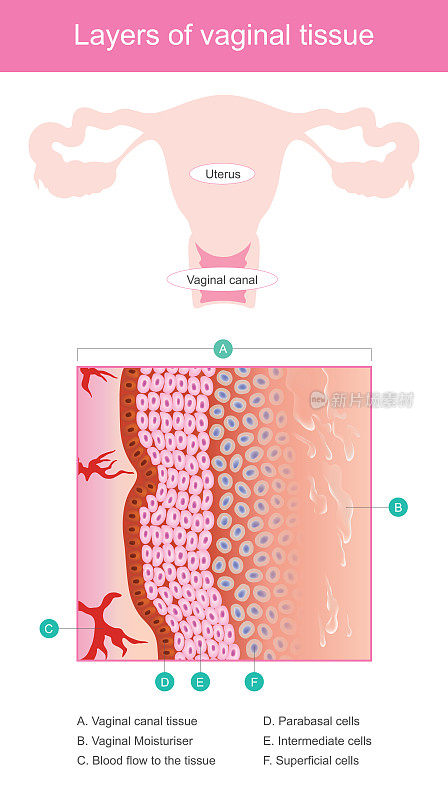 阴道组织层。阴道壁是弹性组织层厚，潮湿，并有良好的血液流动。说明保健和医药。