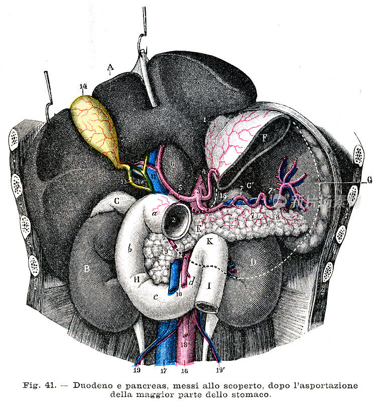 胰腺和十二指肠解剖雕刻1899