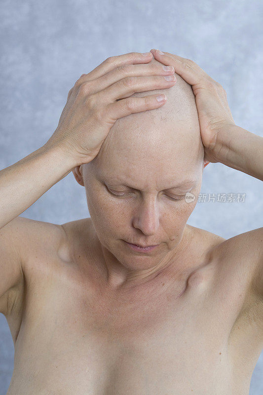 乳癌患者，手放在秃顶上。