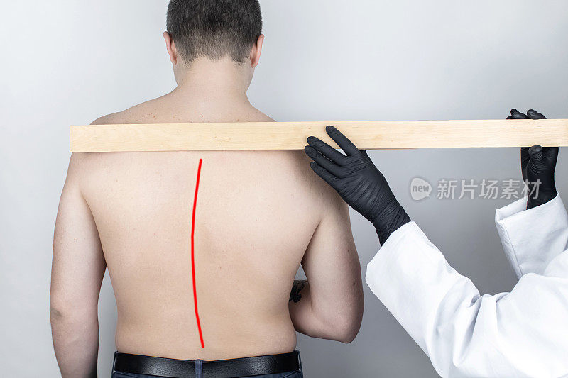 一名男子因背痛而去看医生。脊柱畸形和驼背的治疗。骨质疏松症、脊柱后凸、脊柱前凸或脊柱侧凸。