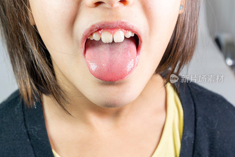 小女孩伸出舌头
