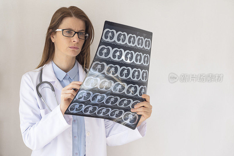 一名女医生正在看核磁共振扫描。