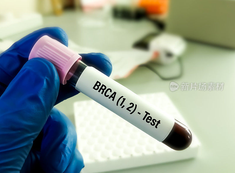BRCA1和BRCA2是两个对对抗癌症很重要的基因，被称为肿瘤抑制基因