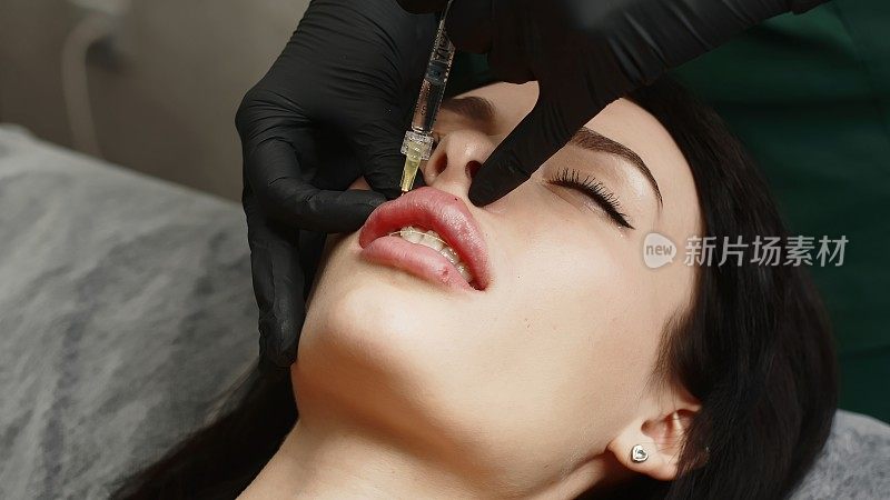一名外科医生戴着医用手套，小心翼翼地用注射器将透明质酸注入一名妇女的嘴唇。丰唇手术。注射美容。