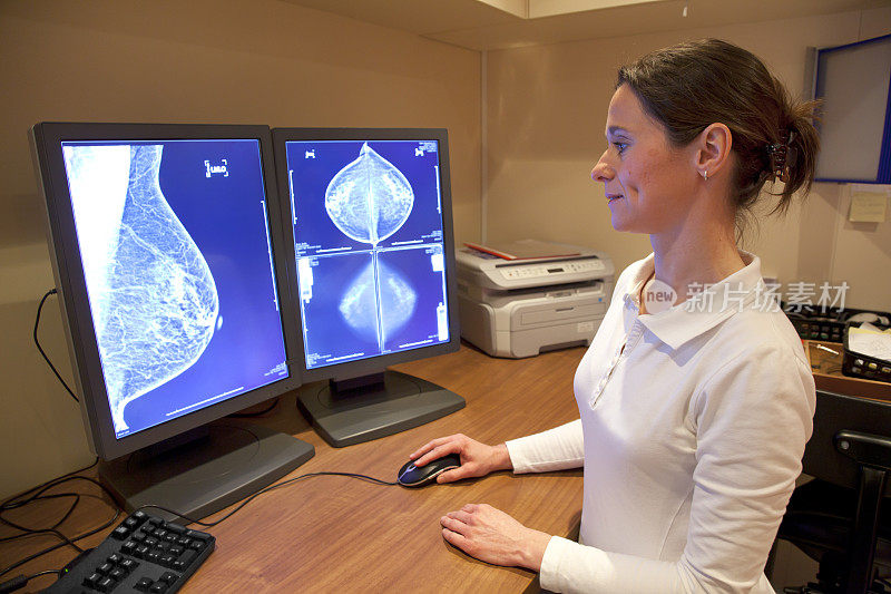 放射科技术员检查乳房x光检查结果