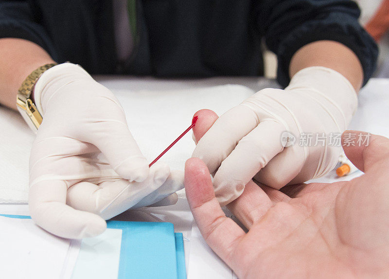 血液检测用的血滴。护士采集献血者的血液用于献血