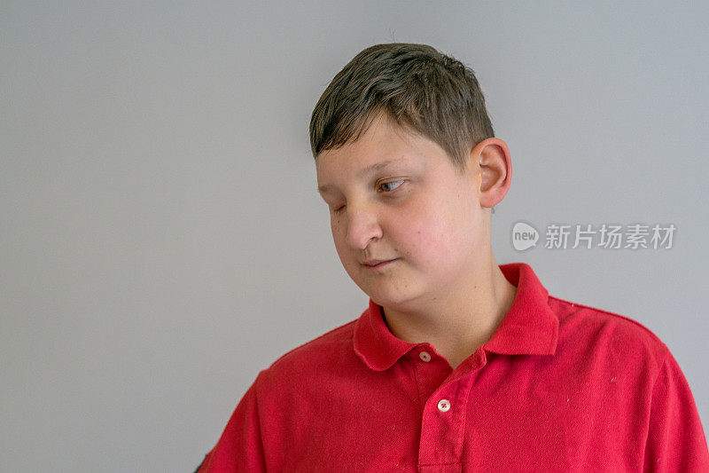 残疾部分失明的男孩肖像