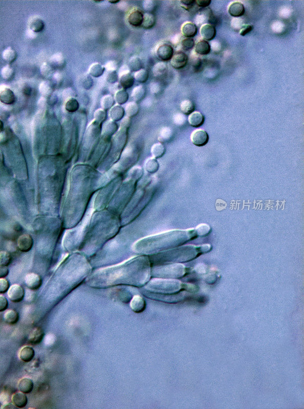 青霉菌的显微镜图像