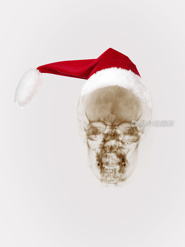 圣诞老人x射线