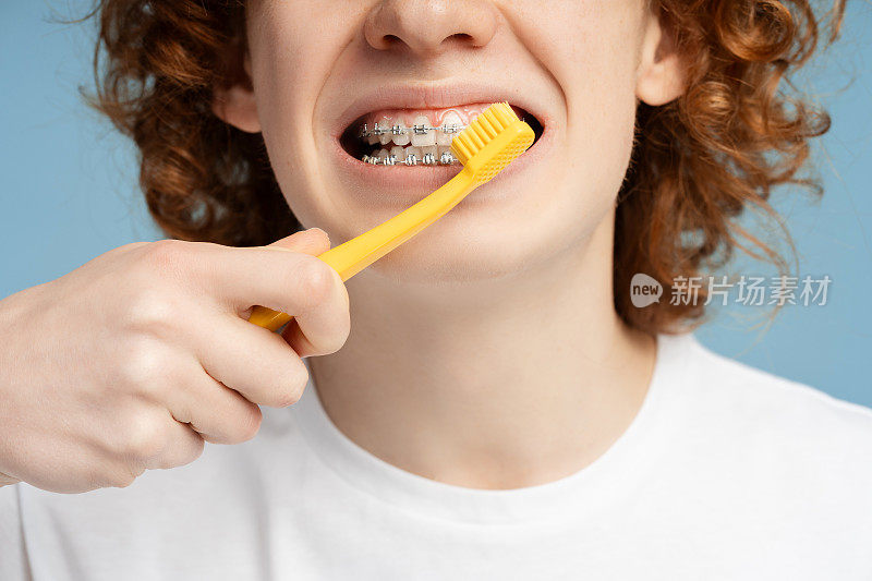 姜黄色头发的十几岁男孩戴着牙套，正在彻底清洁牙齿。牙科护理实践概念
