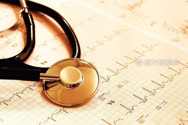 听诊器和心电图仪