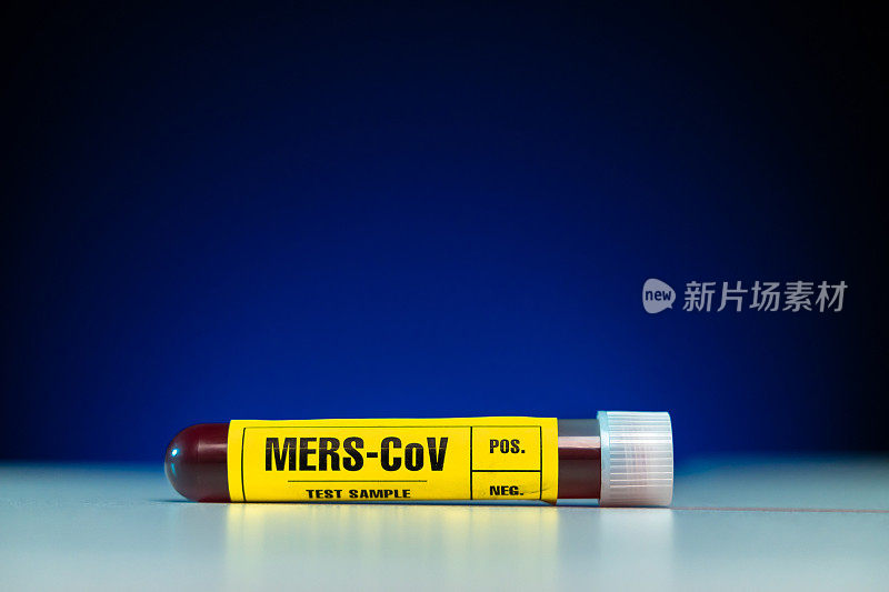 MERS-CoV病毒血样检测管特写黄色标记，蓝色背景