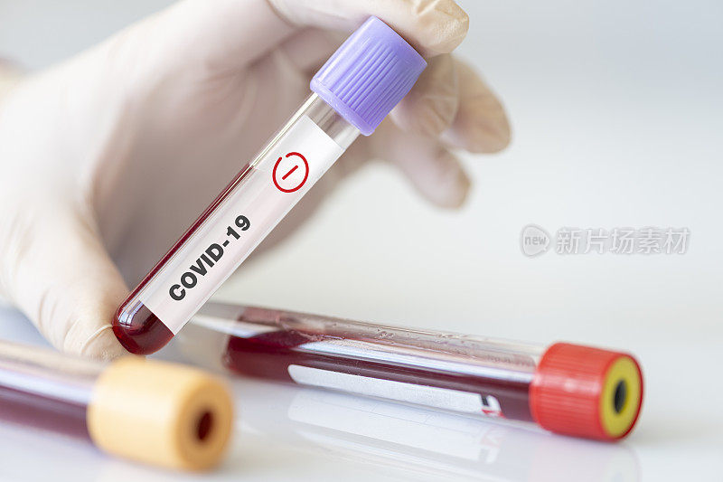 冠状病毒血液检测。实验室冠状病毒阴性血液