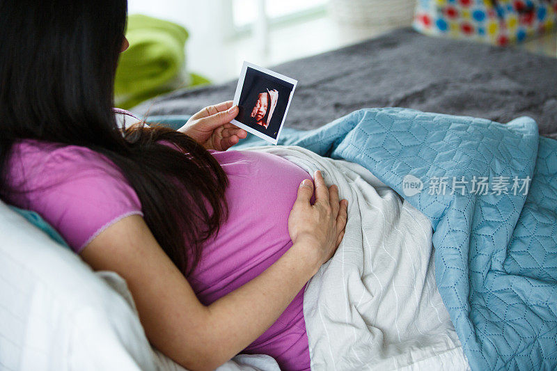 一个孕妇拿着一张超声波照片