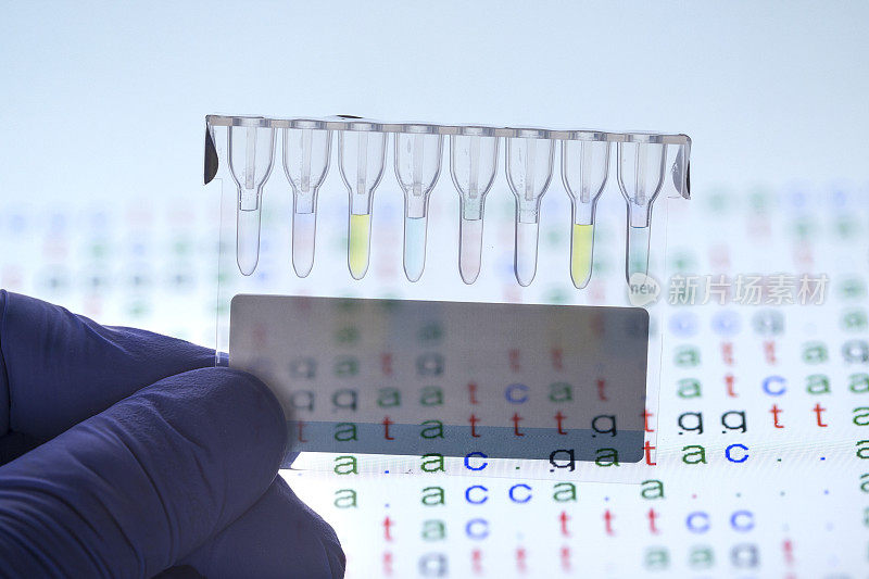 血型检测试剂盒工作室拍摄与DNA代码在背景