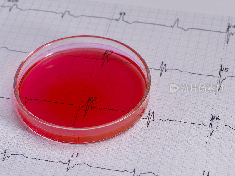 真实心电图和新型冠状病毒血试管没有人。
