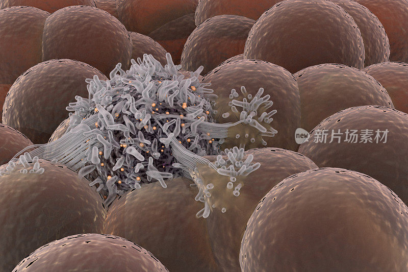 癌细胞在健康的干细胞中扩散