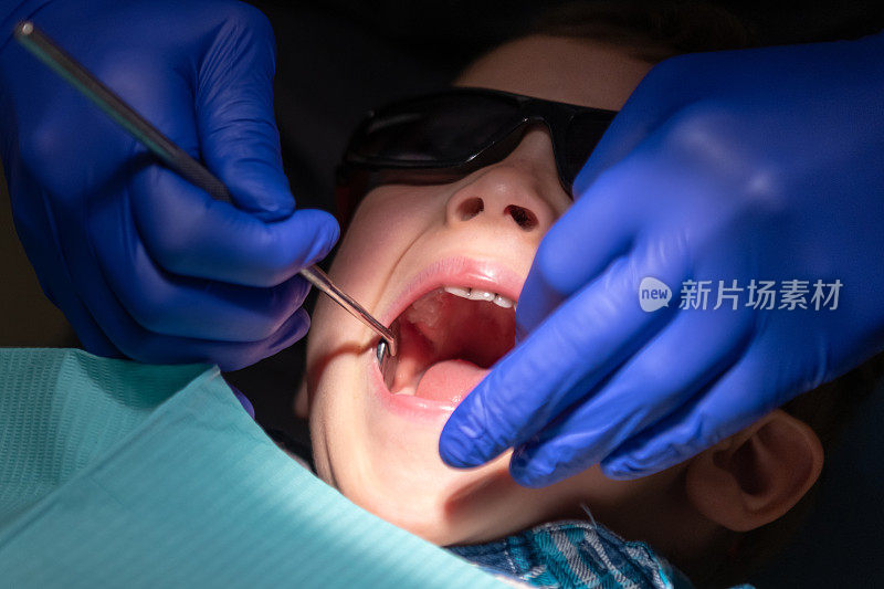 三岁的孩子在牙科医生给他做牙齿检查时，他张着嘴