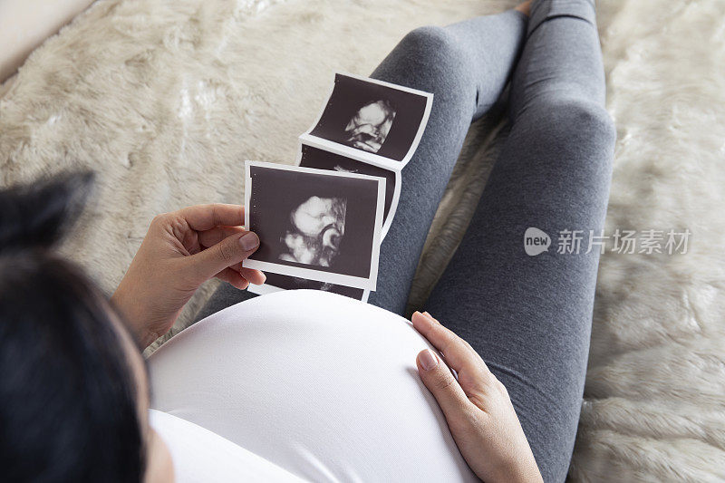 孕妇看她的超声波检查的女婴