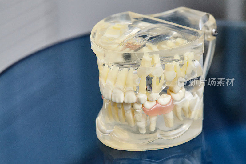 人类颌骨或牙齿矫正模型