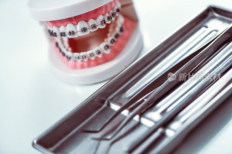牙套模型示例和牙科工具