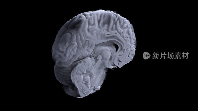 三维可视化的数字MTR的大脑。该模型基于MRI扫描数据。