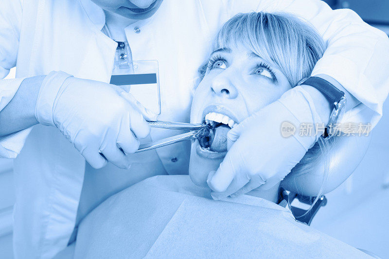 牙科拔牙牙医工作牙科拔牙钳