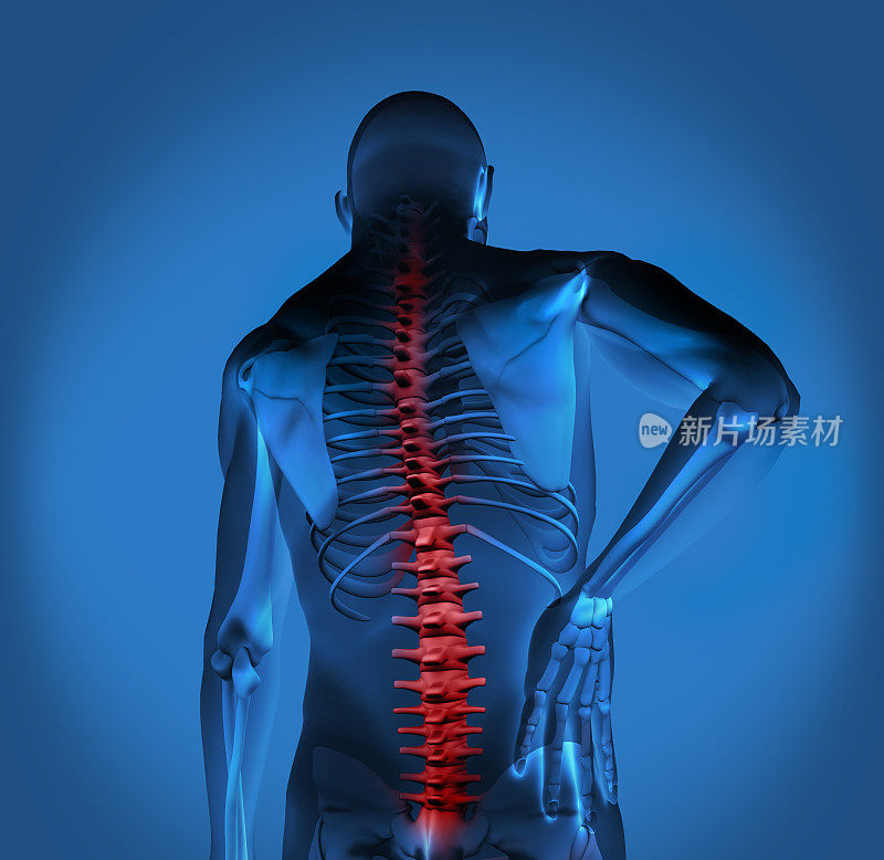 突出脊椎的数字人与背部疼痛