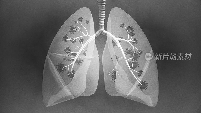 肺部疾病透视x线