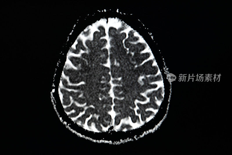 大脑核磁共振扫描。扫描大脑磁共振图像。诊断医疗工具