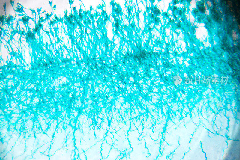 青霉菌在显微镜
