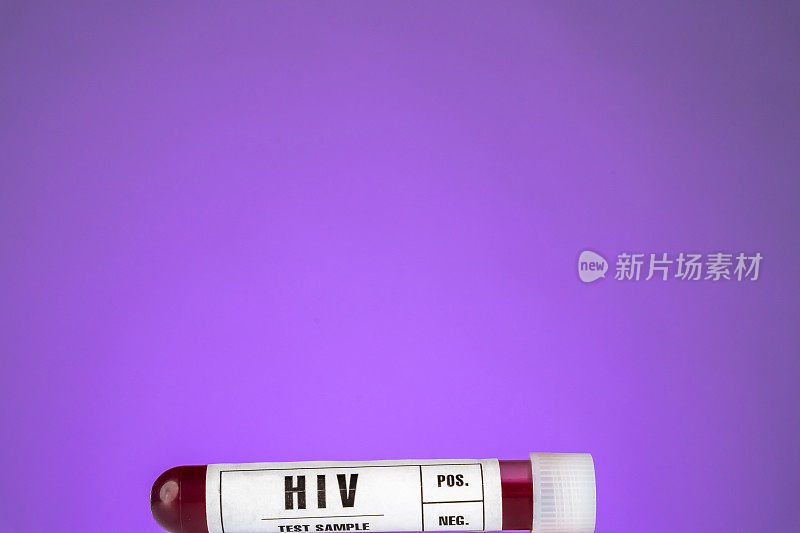 HIV艾滋病病毒血液样本试管特写白色标签，紫色背景