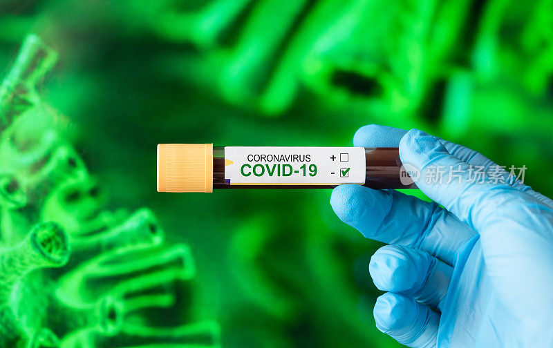 COVID-19血样管阴性