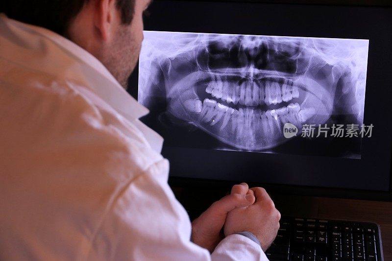 牙医用x光检查病人