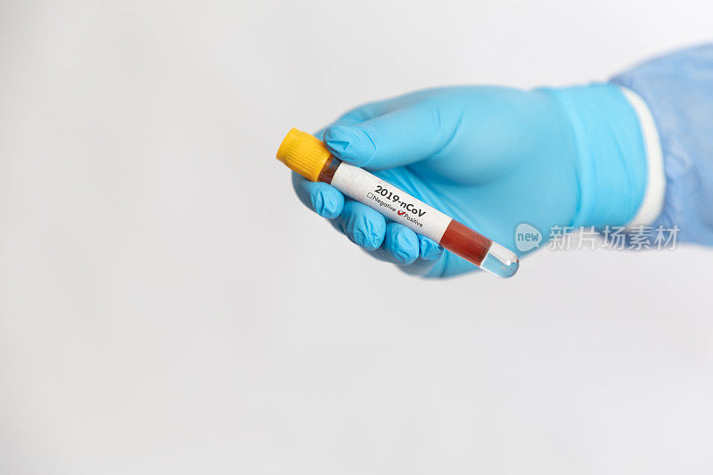 医生在白色背景的试管中拿着阳性冠状病毒样本