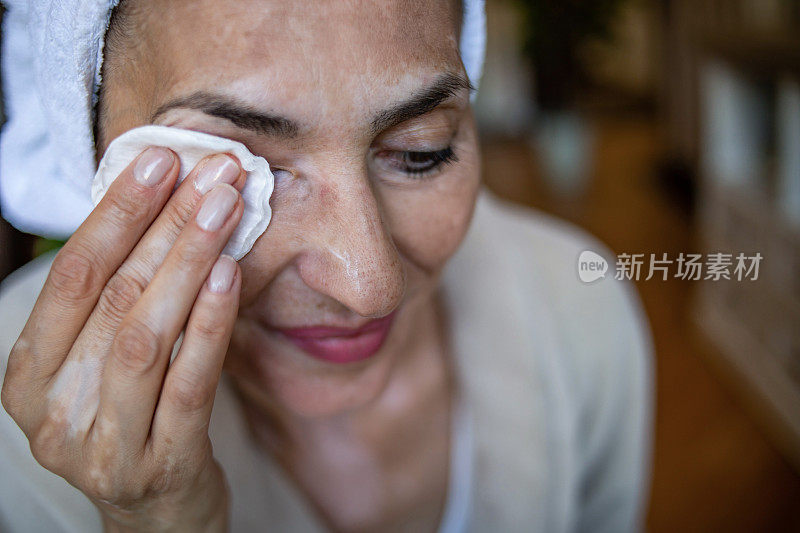 在家里照顾自己美丽的女人。白癜风。