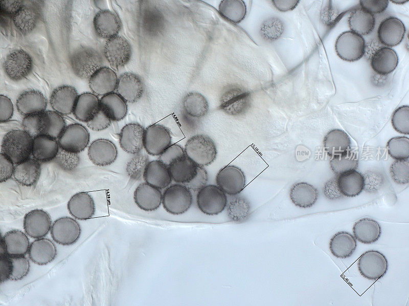 黏菌的孢子。显微镜