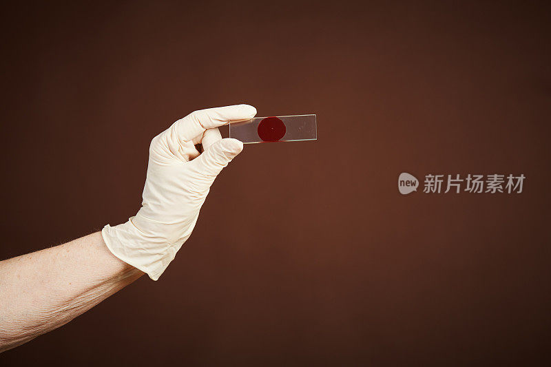 戴着手套的手拿着装有血液标本的显微镜载玻片