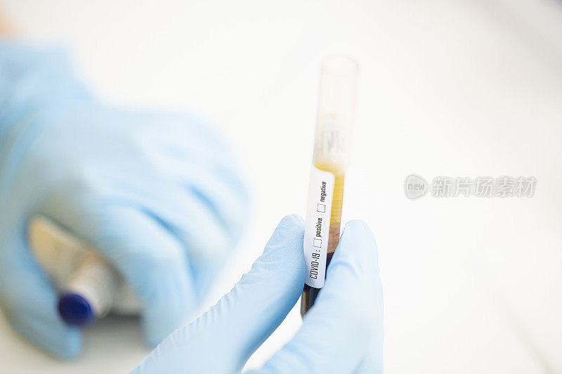 医生在医学实验室工作，使用现代设备检测医学样本。血液检测冠状病毒(COVID-19)、艾滋病、RNA病毒、DNA病毒。