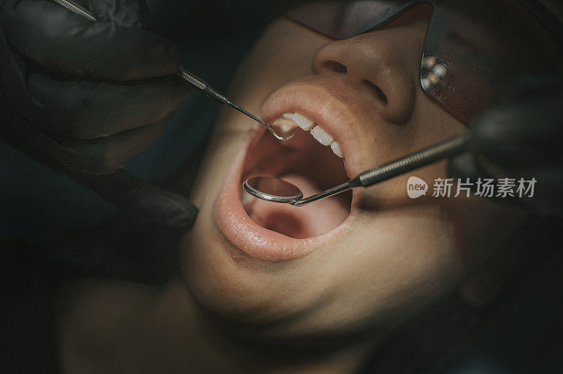 中国少女张口口腔检查