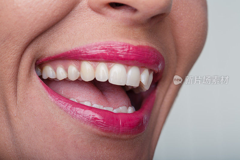 一个成年女性看完牙医后的健康微笑