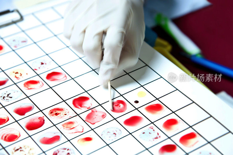血型，血液样本，血液测试病历