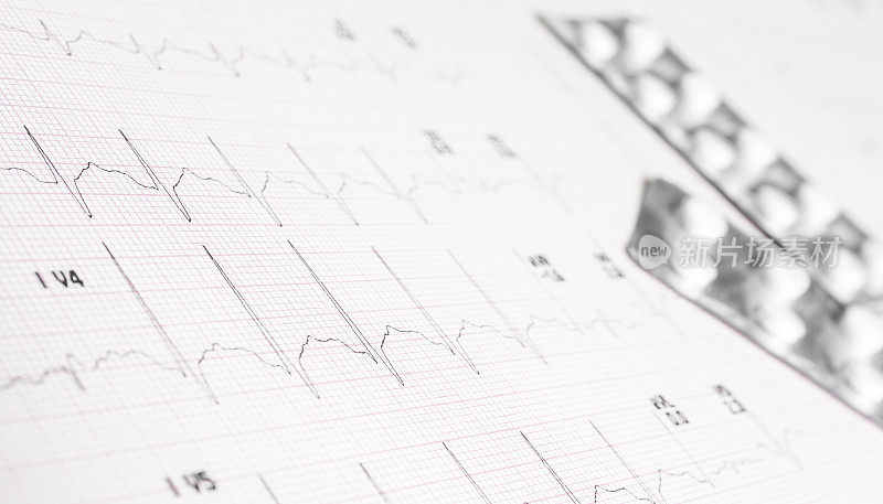 医疗打印和药片上的心率