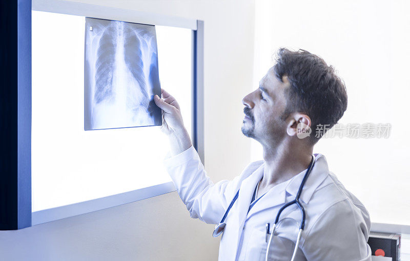 医生在看肺的x光片