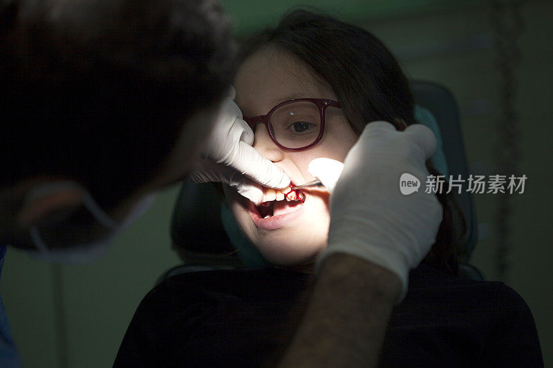 牙科Patient-tooth提取