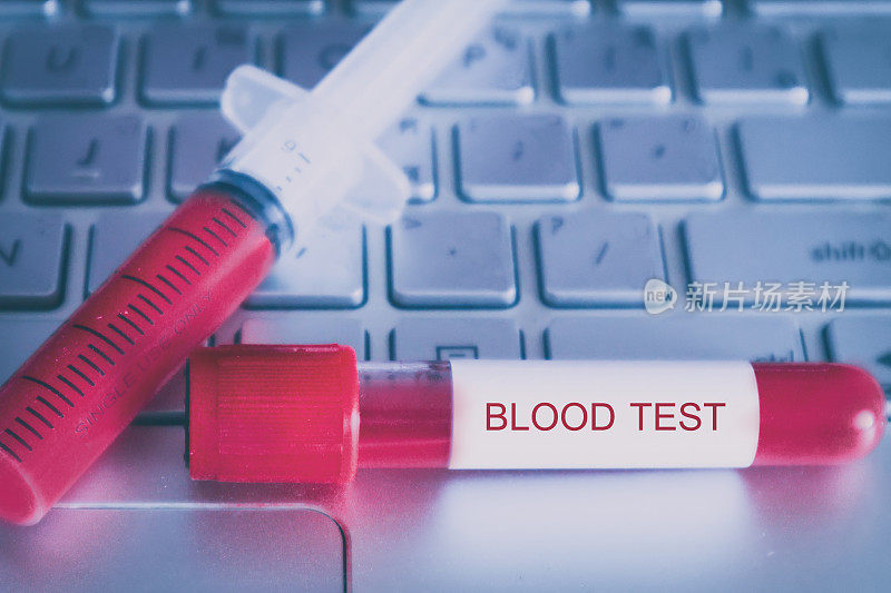 注射器和实验室管血液检测与笔记本电脑的背景。血液测试是使用皮下注射针对血液样本进行的实验室分析